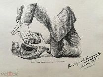 Гравюра массаж, поднятие матки. Геникология. Женщина, врач. Осмотр. Органы. 1889г