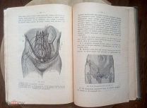 Лекции по женским болезням, читанные в 1897-1898 академических годах. Прижизненные!