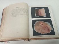 Атлас болезней кожи Dr. E. Jacobi 1908 г.